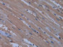 DAB staining on IHC-P; Samples: Rat Heart Tissue; Primary Ab: 20µg/ml Rabbit Anti-Rat NOS2 Antibody Second Ab: 2µg/mL HRP-Linked Caprine Anti-Rabbit IgG Polyclonal Antibody