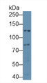 Western Blot; Sample: Mouse Heart lysate; Primary Ab: 2µg/ml Rabbit Anti-Mouse NOS2 Antibody Second Ab: 0.2µg/mL HRP-Linked Caprine Anti-Rabbit IgG Polyclonal Antibody