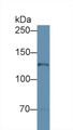 Western Blot; Sample: Mouse Cerebellum lysate; Primary Ab: 2µg/ml Rabbit Anti-Mouse NOS2 Antibody Second Ab: 0.2µg/mL HRP-Linked Caprine Anti-Rabbit IgG Polyclonal Antibody