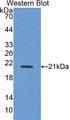 Western Blot; Sample: Recombinant protein.