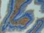 DAB staining on fromalin fixed paraffin- embedded  tissue)