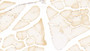 DAB staining on IHC-P; Samples: Human Skeletal muscle Tissue; Primary Ab: 20μg/ml Rabbit Anti-Human NOS2 Antibody Second Ab: 2µg/mL HRP-Linked Caprine Anti-Rabbit IgG Polyclonal Antibody