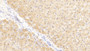 DAB staining on IHC-P; Samples: Human Liver Tissue;  Primary Ab: 20μg/ml Rabbit Anti-Human NOS2 Antibody Second Ab: 2µg/mL HRP-Linked Caprine Anti-Rabbit IgG Polyclonal Antibody 