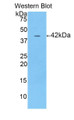 Western Blot; Sample: Recombinant protein.