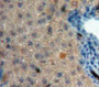 Used in DAB staining on fromalin fixed paraffin-embedded Liver tissue