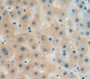 DAB staining on fromalin fixed paraffin-embedded liver tissue)