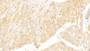 DAB staining on IHC-P; Samples: Rat Heart Tissue; Primary Ab: 20μg/ml Rabbit Anti-Rat vWF Antibody Second Ab: 2µg/mL HRP-Linked Caprine Anti-Rabbit IgG Polyclonal Antibody