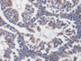 DAB staining on IHC-P; Samples: Mouse Testis Tissue; Primary Ab: 20µg/ml Rabbit Anti-Mouse vWF Antibody Second Ab: 2µg/mL HRP-Linked Caprine Anti-Rabbit IgG Polyclonal Antibody