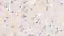 DAB staining on IHC-P; Samples: Human Cerebrum Tissue; Primary Ab: 20μg/ml Rabbit Anti-Human vWF Antibody Second Ab: 2µg/mL HRP-Linked Caprine Anti-Rabbit IgG Polyclonal Antibody