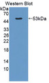 Western Blot; Sample: Recombinant protein.