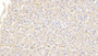 DAB staining on IHC-P; Samples: Canine Liver Tissue;  Primary Ab: 20μg/ml Rabbit Anti-Canine vWF Antibody Second Ab: 2µg/mL HRP-Linked Caprine Anti-Rabbit IgG Polyclonal Antibody 
