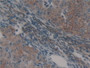 DAB staining on IHC-P; Samples: Mouse Ovary Tissue; Primary Ab: 10µg/ml Rabbit Anti-Mouse HSPD1 Antibody Second Ab: 2µg/mL HRP-Linked Caprine Anti-Rabbit IgG Polyclonal Antibody