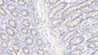 DAB staining on IHC-P; Samples: Human Small intestine Tissue; Primary Ab: 20μg/ml Rabbit Anti-Human HSPD1 Antibody Second Ab: 2µg/mL HRP-Linked Caprine Anti-Rabbit IgG Polyclonal Antibody