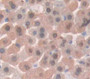 Parathyroid Hormone Related Protein (Pthrp) Polyclonal Antibody, Cat#CAU27043