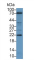 Western Blot; Sample: Human A549 cell lysate; ; Primary Ab: 2µg/ml Rabbit Anti-Human PTHrP Antibody; Second Ab: 0.2µg/mL HRP-Linked Caprine Anti-Rabbit IgG Polyclonal Antibody;