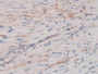 DAB staining on IHC-P;&lt;br/&gt;Samples: Human Prostate Tissue; &lt;br/&gt;Primary Ab: 20µg/ml Rabbit Anti-Human PTHrP Antibody&lt;br/&gt;Second Ab: 2µg/mL HRP-Linked Caprine Anti-Rabbit IgG Polyclonal Antibody&lt;br/&gt;