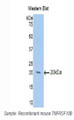 Western Blot; Sample: Recombinant protein.