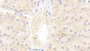 DAB staining on IHC-P; Samples: Human Liver Tissue; Primary Ab: 20μg/ml Rabbit Anti-Human TNFRSF10B Antibody Second Ab: 2µg/mL HRP-Linked Caprine Anti-Rabbit IgG Polyclonal Antibody