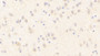 DAB staining on IHC-P; Samples: Rat Cerebrum Tissue; Primary Ab: 20μg/ml Rabbit Anti-Rat NOS1 Antibody Second Ab: 2µg/mL HRP-Linked Caprine Anti-Rabbit IgG Polyclonal Antibody