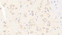 DAB staining on IHC-P; Samples: Mouse Cerebrum Tissue; Primary Ab: 5μg/ml Rabbit Anti-Mouse NOS1 Antibody Second Ab: 2µg/mL HRP-Linked Caprine Anti-Rabbit IgG Polyclonal Antibody