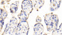 DAB staining on IHC-P; Samples: Human Placenta Tissue;  Primary Ab: 20μg/ml Rabbit Anti-Human PAPPA Antibody Second Ab: 2µg/mL HRP-Linked Caprine Anti-Rabbit IgG Polyclonal Antibody 