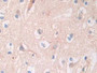 DAB staining on IHC-P; Samples: Human Cerebrum Tissue; Primary Ab: 30µg/ml Rabbit Anti-Human AGT Antibody Second Ab: 2µg/mL HRP-Linked Caprine Anti-Rabbit IgG Polyclonal Antibody