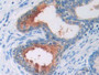 DAB staining on IHC-P; Samples: Human Prostate Tissue)