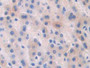 DAB staining on IHC-P; Samples: Human Liver Tissue; Primary Ab: 30µg/ml Rabbit Anti-Human AGT Antibody Second Ab: 2µg/mL HRP-Linked Caprine Anti-Rabbit IgG Polyclonal Antibody