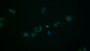 FITC staining on IF; Samples: Human Hela cell;  Primary Ab: 20μg/ml Rabbit Anti-Rat CDKN2A Antibody Second Ab: 1μg/ml FITC-Linked Caprine Anti-Rabbit IgG Polyclonal Antibody 