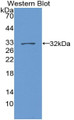 Western Blot; Sample: Recombinant protein.