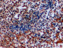 DAB staining on fromalin fixed paraffin-embedded Ovary tissue)