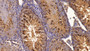 DAB staining on fromalin fixed paraffin- embedded testis tissue)