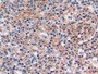 DAB staining on IHC-P; Samples: Human Tonsil Tissue; Primary Ab: 20µg/ml Rabbit Anti-Human PDCD1LG2 Antibody Second Ab: 2µg/mL HRP-Linked Caprine Anti-Rabbit IgG Polyclonal Antibody