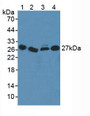 Western Blot; Sample: Lane1: Human Serum; Lane2: Human Liver Tissue; Lane3: Human Lung Tissue; Lane4: Human Jurkat Cells.