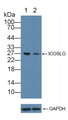 Knockout Varification: ; Lane 1: Wild-type Jurkat cell lysate; ; Lane 2: ICOSLG knockout Jurkat cell lysate; ; Predicted MW: 33kd ; Observed MW: 27kd; Primary Ab: 2µg/ml Rabbit Anti-Human ICOSLG Antibody; Second Ab: 0.2µg/mL HRP-Linked Caprine Anti-Rabbit IgG Polyclonal Antibody;