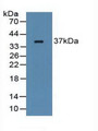 Western Blot; Sample: Rat Serum.