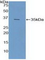 Western Blot; Sample: Recombinant FCN1, Mouse.