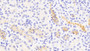 DAB staining on IHC-P; Samples: Human Kidney Tissue;  Primary Ab: 20μg/ml Rabbit Anti-Human Kim1 Antibody Second Ab: 2µg/mL HRP-Linked Caprine Anti-Rabbit IgG Polyclonal Antibody 