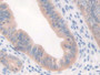 DAB staining on IHC-P; Samples: Mouse Uterus Tissue; Primary Ab: 10µg/ml Rabbit Anti-Mouse CFP Antibody Second Ab: 2µg/mL HRP-Linked Caprine Anti-Rabbit IgG Polyclonal Antibody