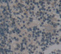 Complement Factor P (Cfp) Polyclonal Antibody, Cat#CAU27151
