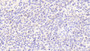 DAB staining on IHC-P; Samples: Human Spleen Tissue;  Primary Ab: 20μg/ml Rabbit Anti-Human CFP Antibody Second Ab: 2µg/mL HRP-Linked Caprine Anti-Rabbit IgG Polyclonal Antibody 