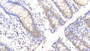 DAB staining on IHC-P; Samples: Human Colon Tissue; Primary Ab: 20μg/ml Rabbit Anti-Human CA2 Antibody Second Ab: 2µg/mL HRP-Linked Caprine Anti-Rabbit IgG Polyclonal Antibody