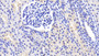 DAB staining on IHC-P; Samples: Human Kidney Tissue; Primary Ab: 20μg/ml Rabbit Anti-Human CA2 Antibody Second Ab: 2µg/mL HRP-Linked Caprine Anti-Rabbit IgG Polyclonal Antibody