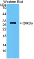 Western Blot; Sample: Recombinant protein.