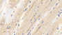 DAB staining on IHC-P; Samples: Human Cardiac Muscle Tissue;  Primary Ab: 30µg/ml Rabbit Anti-Human PDHa Antibody Second Ab: 2µg/mL HRP-Linked Caprine Anti-Rabbit IgG Polyclonal Antibody 