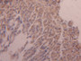 DAB staining on IHC-P; Samples: Mouse Adrenal gland Tissue;  Primary Ab: 20µg/ml Rabbit Anti-Mouse H