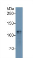 Western Blot; Sample: Mouse Heart lysate; Primary Ab: 1µg/ml Rabbit Anti-Mouse HK1 Antibody Second Ab: 0.2µg/mL HRP-Linked Caprine Anti-Rabbit IgG Polyclonal Antibody