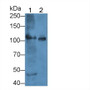 Western Blot; Sample: Lane1: Mouse Cerebrum lysate; Lane2: Mouse Heart lysate&lt;br/&gt;Primary Ab: 2µg/mL Rabbit Anti-Human HK1-2 Antibody&lt;br/&gt;Second Ab: 0.2µg/mL HRP-Linked Caprine Anti-Rabbit IgG Polyclonal Antibody&lt;br/&gt;