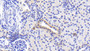 DAB staining on IHC-P; Samples: Human Kidney Tissue;  Primary Ab: 20μg/ml Rabbit Anti-Human HK1 Antibody Second Ab: 2µg/mL HRP-Linked Caprine Anti-Rabbit IgG Polyclonal Antibody 