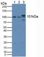 Western Blot; Sample: Lane1: Human Lung Tissue; Lane2: Mouse Lung Tissue; Lane3: Mouse Brain Tissue.